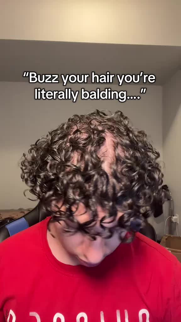get the hair filler from my bio before it sells out #curlyhair #balding #fyp #thinhair #lowdensity
