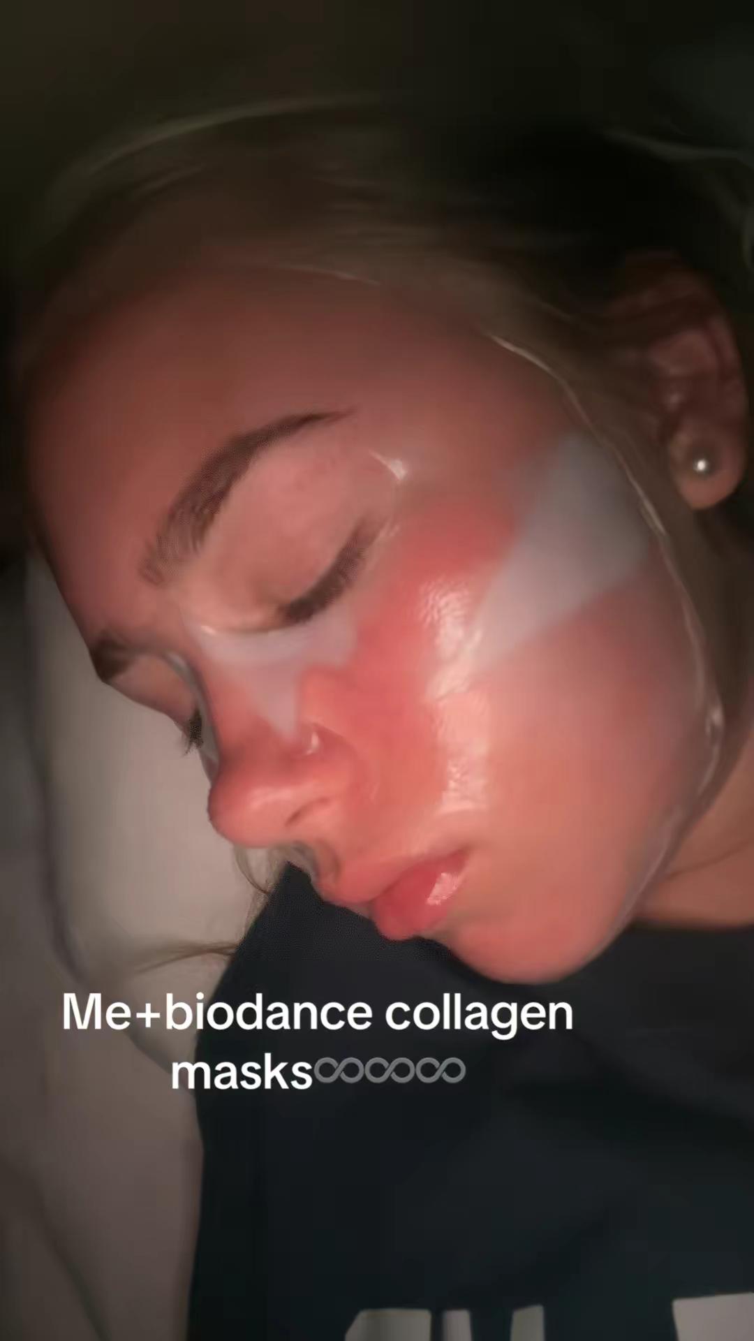 #acne #biodance #collagenmask #fyp